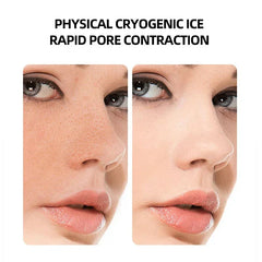 Hot Cold Hammer for Skin Rejuvenation, Tightening & Anti-Wrinkle - Dual-Therapy, Ergonomic Design, All Skin Types