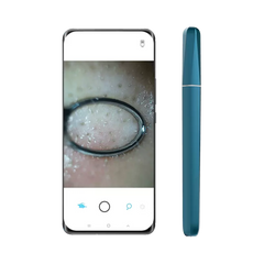 WIFI Smart Visible Pore Ceansing 1.0 Megapixels Blackhead Remover Pore Cleaner 200mAh IPX6 Waterproof Portable Rechargeable Pore Cleanser