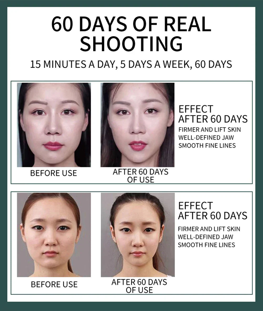 TEMS Microcurrent Face-Lifting Device - Stimulates Collagen, Reduces Fine Lines, Enhances Skin Vitality, 12 Gears, 5 Modes