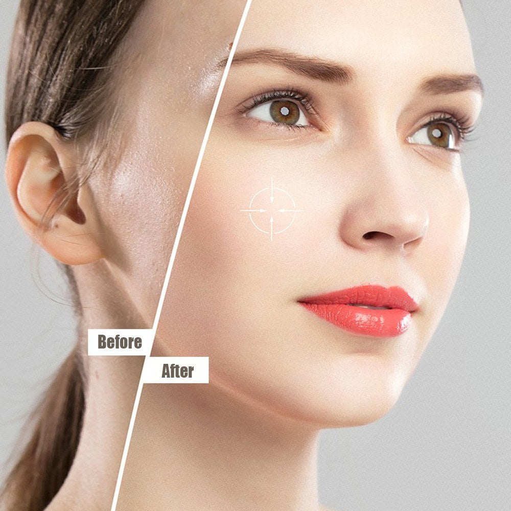 Handheld RF High Frequency Skin Therapy Wand
