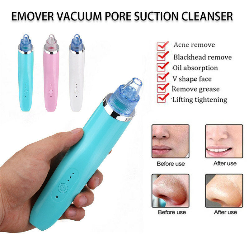 Face Facial Cleansing DC5V 850mA USB Electric Nose Pore Cleanser Cleaner Vacuum Beauty Machine Blackhead Zit Acne Remover Tool