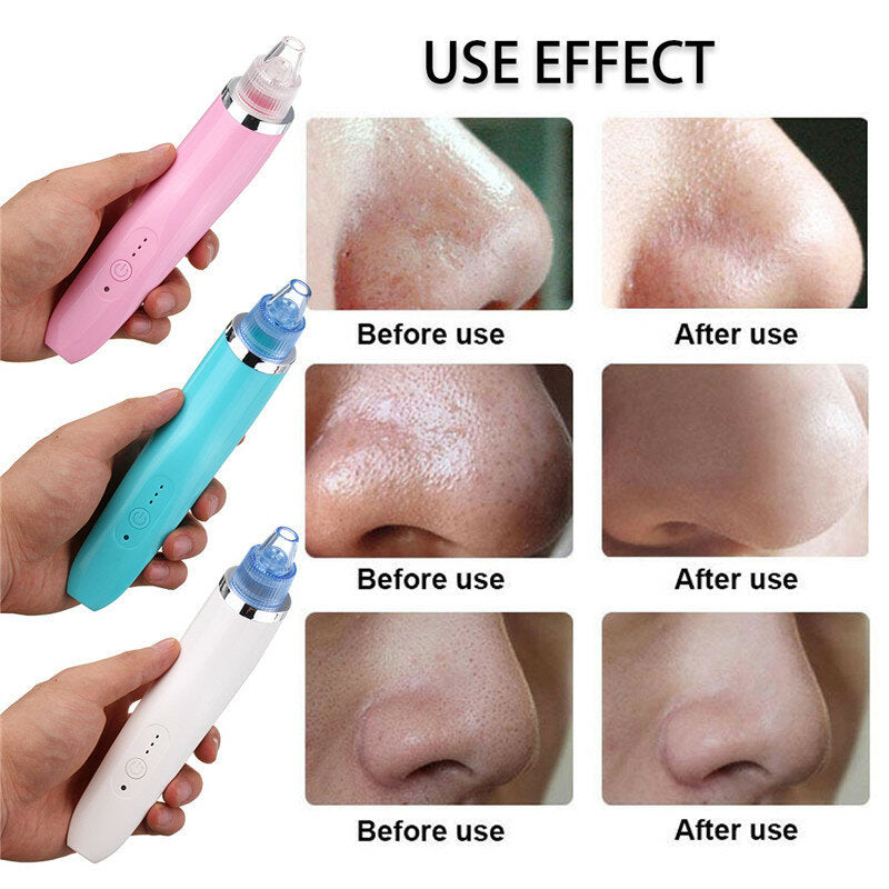 Face Facial Cleansing DC5V 850mA USB Electric Nose Pore Cleanser Cleaner Vacuum Beauty Machine Blackhead Zit Acne Remover Tool