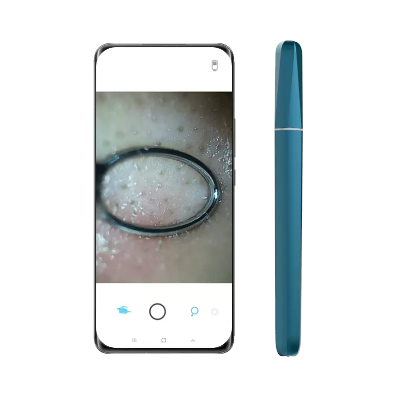 WIFI Smart Visible Pore Ceansing 1.0 Megapixels Blackhead Remover Pore Cleaner 200mAh IPX6 Waterproof Portable Rechargeable Pore Cleanser